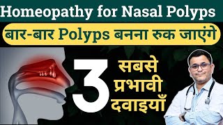 Nasal polyps homeopathic medicine Best Homeopathic treatment for nasal polyps RxHpathy [upl. by Ahtaga]