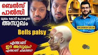 1248ചിരിക്കാനോ കണ്ണടയ്ക്കാനോ കഴിയുന്നില്ല എന്താണ് മിഥുൻ രമേശിനെ ബാധിച്ച ബെൽസ് പാൾസി Bell’s palsy [upl. by Ahsimak]