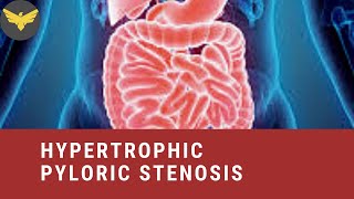 HYPERTROPHIC PYLORIC STENOSIS [upl. by Beata]