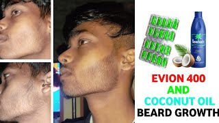 Evion 400 for beard growthevion 400 and coconut oil for beard growthhow to use evion 400 for beard [upl. by Lainey]