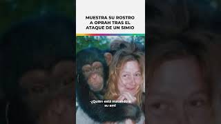 Mujer atacada por chimpancé muestra su rostro a Oprah Shorts [upl. by Oirifrop616]