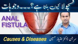 Causes of Perianal Fistula  Most common cause of fistula formation  Surgeon Dr Imtiaz Hussain [upl. by Naud]