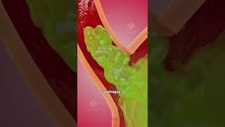 How acid reflux happens 🥵 Acidity and gas problem  GERD shorts viralvideo  creativelearning3d [upl. by Blight]