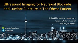 Ultrasound Imaging in Obesity for Epidural  Spinal Anesthesia amp Lumbar Puncture [upl. by Dart]