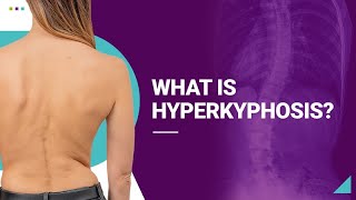 What is Hyperkyphosis [upl. by Tellford]