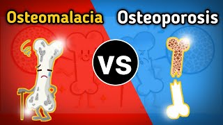 Osteomalacia vs osteoporosis  Difference between osteomalacia vs osteoporosis [upl. by Aldarcy738]