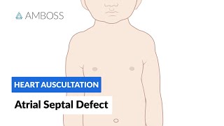 Life after Atrial Septal Defect Closure [upl. by Bennion]