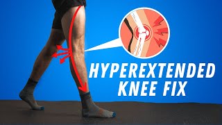 CORRECT Your Hyperextended Knees Fast NO EQUIPMENT NEEDED [upl. by Parfitt]