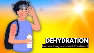 What is Dehydration Causes Signs and Symptoms Diagnosis and Treatment [upl. by Rramahs]