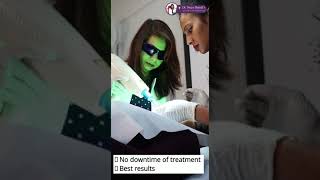 Freckles Treatment by Dermatologist  How to Get Rid of Freckles  Dr Naiya Bansal [upl. by Birdie356]