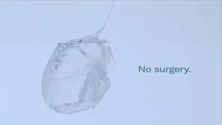 Allurion Intragastric Balloon [upl. by Euqimod425]