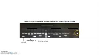 Amplification Refractory Mutation System  ARMS [upl. by Eaj771]