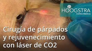 Cirugía de párpados y rejuvenecimiento con láser de CO2 16134 [upl. by Brit113]