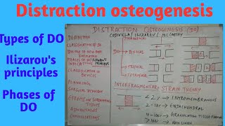 Distraction Osteogenesis partI [upl. by Llesram958]