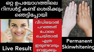 മുഖം വെളുക്കണോ ഒറ്റ തവണ തേകുമ്പോ കിട്ടുന്ന വെളുപ്പ് കണ്ടാൽ ദിവസവും ചെയ്യും skinwhitening at home [upl. by Slade]