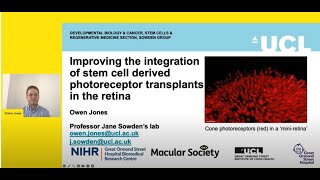 Research into the use of stem cellderived photoreceptors for macular repair with PhD Owen Jones [upl. by Elime]