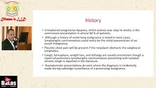 Pulmonary Lymphangitis Carcinomatosis [upl. by Damicke272]