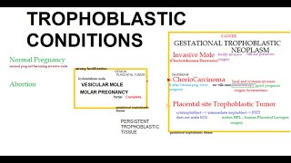 Pathology 750 Placenta Tumor Hydatidiform mole complete partial molar ChorioCarcinoma obstetrics [upl. by Ayres]