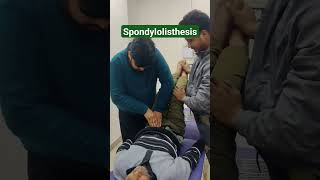 spondylolisthesis treatment chiropractic legpain pain legpainexercises physiotherapy sciatic [upl. by Ashmead]