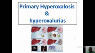 Highlights on primary oxalosis and oxaliruia [upl. by Mixie]