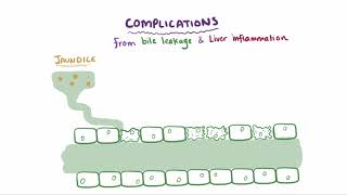 Primary biliary cholangitis causes symptoms diagnosis treatment amp pathology [upl. by Scott276]