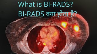 BIRADS क्या होता है What is BIRADS birads breastcancer petct fdg fdgpetscan petctscan [upl. by Alol]