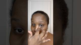 Get rid of hyperpigmentation skincare skincareroutine shorts skincareshorts skincareproducts [upl. by Lindeberg]