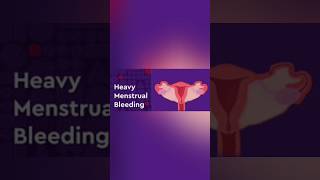 Heavy periods  menorrhagia [upl. by Blackburn]