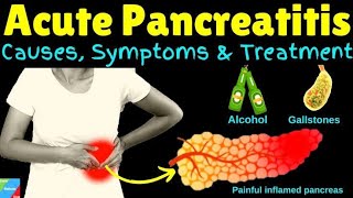 Pancreatitis Types signs and Treatment BSC Nursingyoutubevideos [upl. by Nannie]