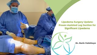 Lipedema Surgery Update PowerAssisted Leg Suction for Significant Lipedema  Dr Boris Volshteyn [upl. by Jopa]