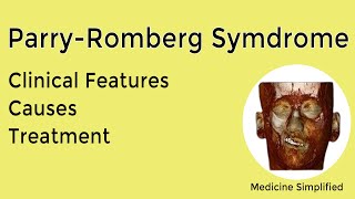 Parry Romberg Syndrome  Causes Symptoms Treatment and Clinical Features [upl. by Nodearb133]