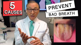 Top 5 CAUSES of BAD BREATH  How to Prevent it [upl. by Eceela]