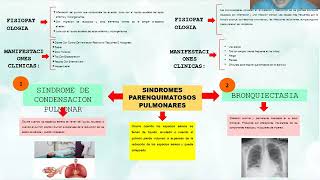 SINDROME PARENQUIMATOSO PULMONAR [upl. by Laurice]