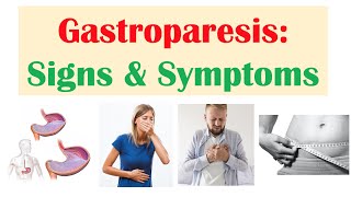 Gastroparesis Signs amp Symptoms ex Nausea Abdominal Pain Weight Loss [upl. by Vick]