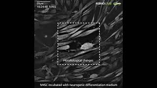 Stem cell differentiation into neuronal cells [upl. by Ramonda]