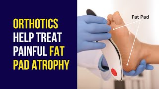 How Orthotics Help in Painful Foot Fat Pad Atrophy Treatment [upl. by Ause545]