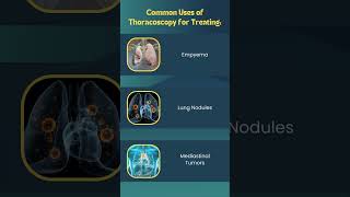 Lets Understand About Thoracoscopy [upl. by Weywadt726]