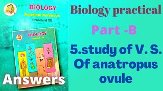 5study of V S Of anatropus ovule Biology practical class 12 practical 5 [upl. by Wightman]