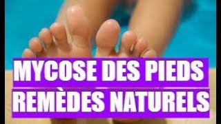 👉 MYCOSE DES PIEDS ★★★★★ REMÈDES NATURELS [upl. by Muscolo]