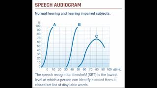 Speech Audiometry [upl. by Ehtyde]