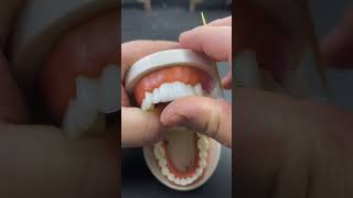 How teeth are designed hospital dentist teeth shortvideo shortsyoutube shorts [upl. by Kathe387]