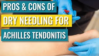 Dry Needling For Achilles Tendinopathy  Tendonitis — Does It Help [upl. by Yrannav]