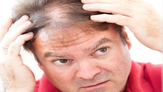 How to Regrow Hair in Thinning Areas  Hair Regrowth Tips [upl. by Ynabe879]