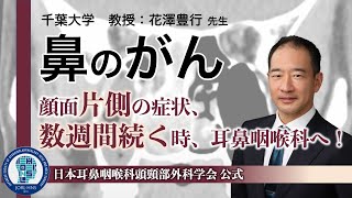 鼻副鼻腔がんについて詳しく解説 −頭頸部外科月間2022 [upl. by Iridis]