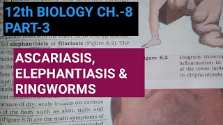 Class 12 biology chapter 8part 3human diseasesStudy with Farru [upl. by Camile]