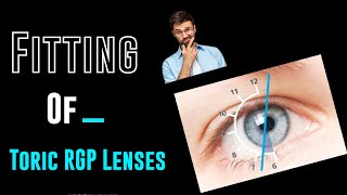 Fitting Of Toric RGP contact lensesfront back surfacebitoric and peripheral lens designoptometry [upl. by Farrand]