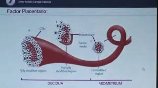 fisiopatologia de la preeclamsia [upl. by Ynwat]