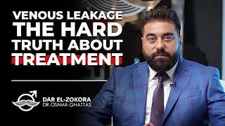 Venous Leakage The Hard Truth About Treatment [upl. by Harbert810]