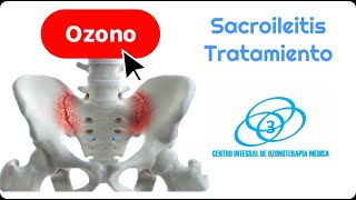 Sacroileitis en la Discartrosis Lumbar tratamiento [upl. by Jamal]