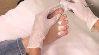 Tuto nail art pour ongles de pied  technique du millefeuille  ndedfr [upl. by Annovad]